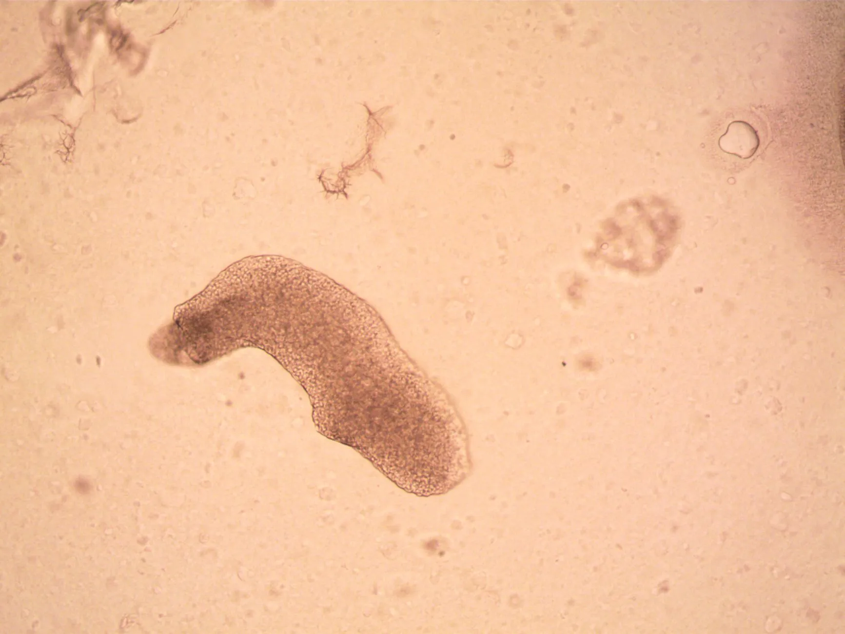 MBR膜生物反应器与传统活性污泥法在工业废水处理中的对比研究